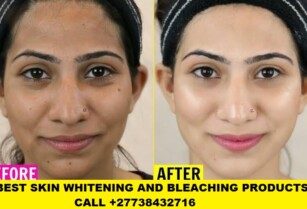 Permanent Skin Lightening Skin Whitening Products +27738432716